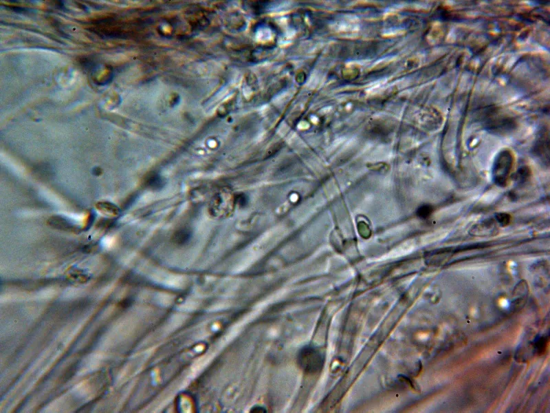 Clitocybe nebularis 18 - Pileipellis 1
